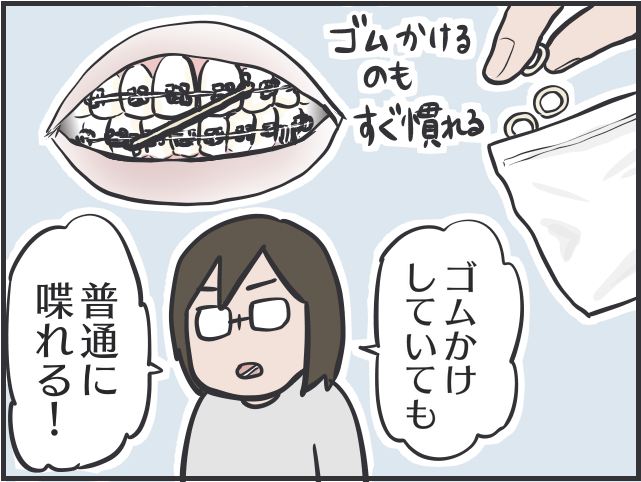 目に見えて綺麗に並んでいく歯に感動！ 2年半でここまで変わった、大人の「歯科矯正」体験記／フニャコ 大人の歯科矯正3.PNG