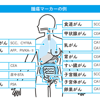 腫瘍マーカについて コラム 岐阜健康管理センター