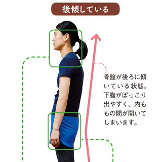 日本人女性の9割は骨盤が後倒 体のゆがみ 基礎知識 毎日が発見ネット