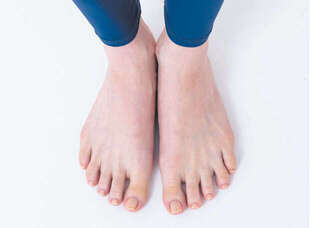 【坐骨神経痛対策】自分の足の状態が分かる4つのポイント。小さな段差につまずく方は要注意!