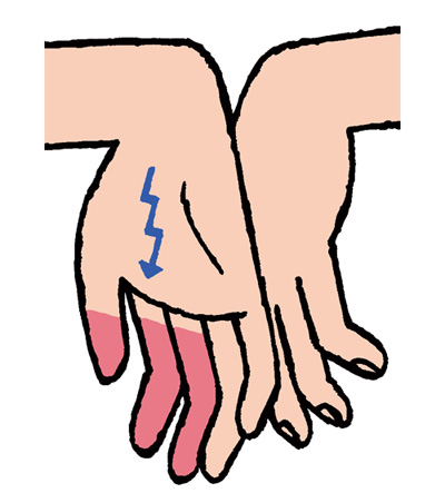 「夜間や明け方にしびれが強くなる」...その手指の痛み、腫れ、しびれはこんな病気！／手指の痛み改善法（2） 002.jpg