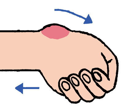 「夜間や明け方にしびれが強くなる」...その手指の痛み、腫れ、しびれはこんな病気！／手指の痛み改善法（2） 006.jpg
