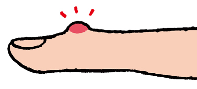 手の指の第一関節、第二関節、親指の付け根が、腫れる、曲がる、痛むは要注意！／手指の痛み改善法（3） 008.jpg