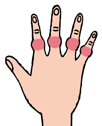 手の指の第一関節 第二関節 親指の付け根が 腫れる 曲がる 痛むは要注意 手指の痛み改善法 3 毎日が発見ネット