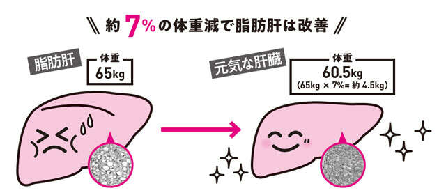 「肝臓」は実はやせやすい！「脂肪肝」を改善するための期間を医師・尾形哲先生が解説 0201.jpg