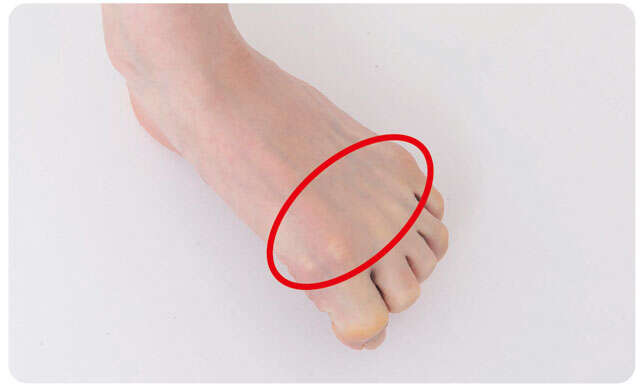 【坐骨神経痛対策】自分の足の状態が分かる4つのポイント。小さな段差につまずく方は要注意！ 0101-2.jpg