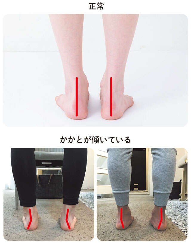 【坐骨神経痛対策】自分の足の状態が分かる4つのポイント。小さな段差につまずく方は要注意！ 0101-4.jpg