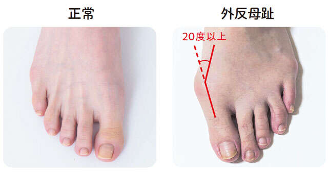 【坐骨神経痛対策】自分の足の状態が分かる4つのポイント。小さな段差につまずく方は要注意！ 011-1.jpg