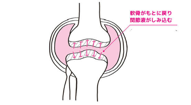 【ひざの寿命を延ばす！】ひざの痛みと変形を防ぐために「軟骨を守る」方法 0103.jpg
