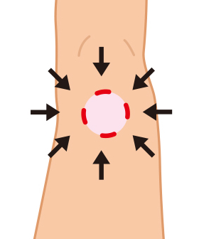 ひざ痛をその原因から解決！（１）あなたのそのひざの痛み、変形性ひざ関節症では？ 017S_1.jpg