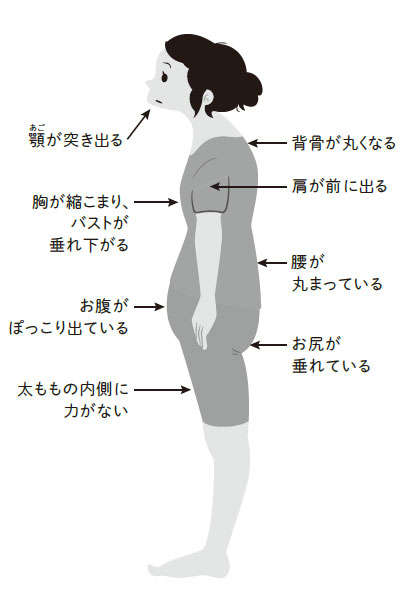 ねこ背は現代病？ 頭痛、肩こり、腰痛に悩んだら姿勢を確認／きれいな姿勢に生まれ変わる ねこ背伸ばし 025-1.jpg