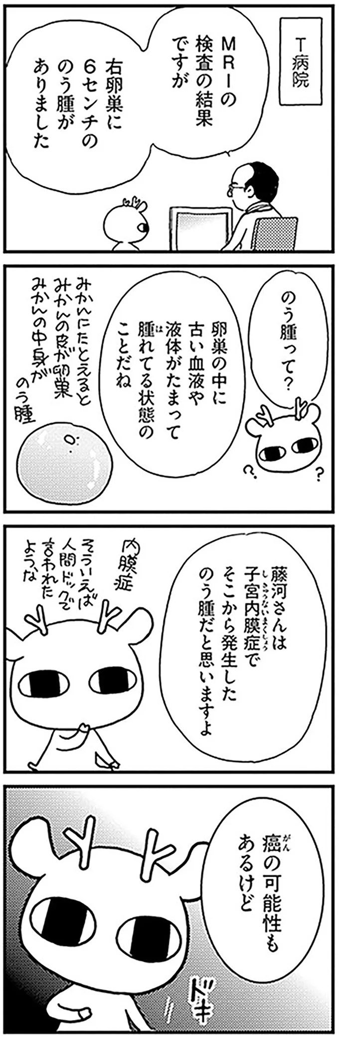 「がんの可能性もあるけど」。右卵巣に6センチの「のう腫」が...！／元気になるシカ！  03-01.png