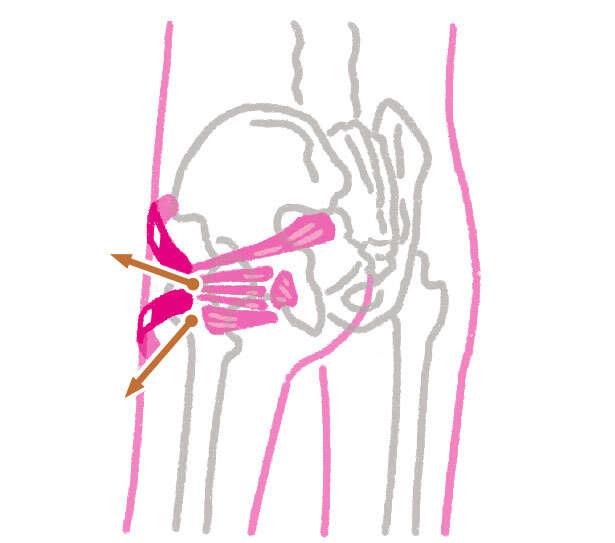【坐骨神経痛の原因と対策】「絆創膏」で原因の筋肉にアプローチする方法 0704.jpg