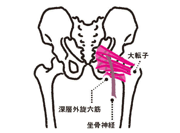 【坐骨神経痛の原因と対策】「絆創膏」で原因の筋肉にアプローチする方法 0702.jpg