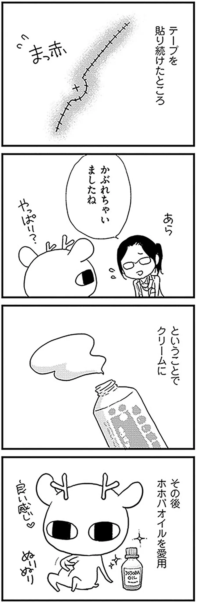 見たいけど怖い...！ 卵巣がん手術の跡はどうなってる？／元気になるシカ！  11-07.png