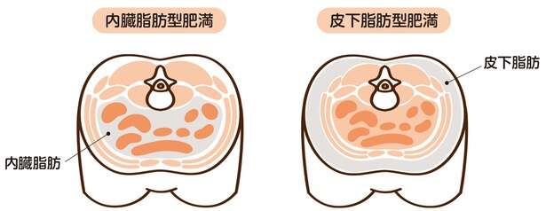 「洋なし型肥満」はなぜ女性に多いのか。お腹・太ももの皮下脂肪とホルモンの関係 14901170_615.jpg