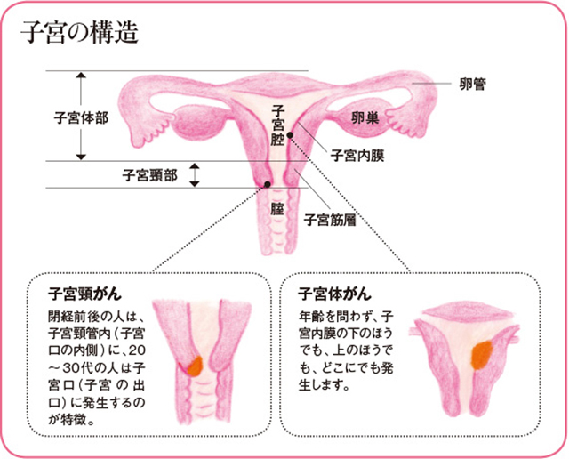 最近、シニア世代に増加傾向！　閉経前後からは子宮体がん、卵巣がんに注意しましょう 1512shikyutaigan_03.jpg