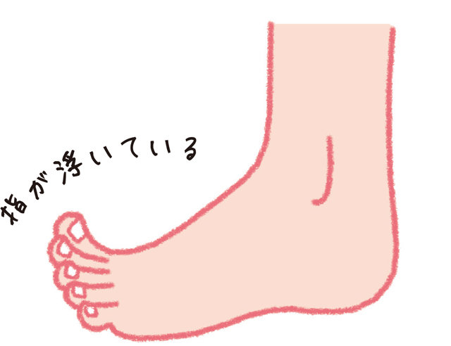 浮き指、浮き上げ指、タコ・うおのめ。女性に多い足の不調／足指力を鍛える（６） 1801p62_01.jpg