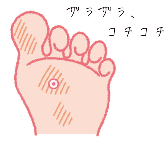 浮き指、浮き上げ指、タコ・うおのめ。女性に多い足の不調／足指力を鍛える（６） 1801p62_04.jpg