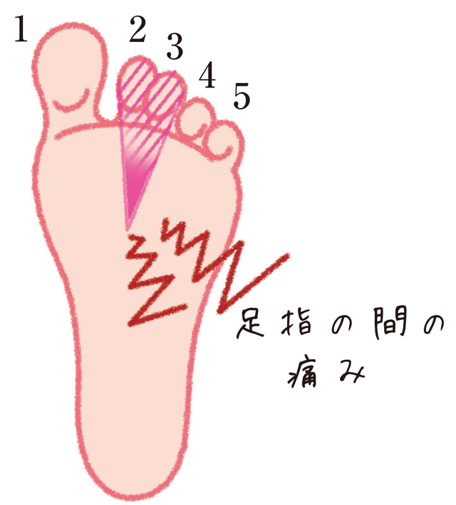 足の不調は多種多様。足の痛みはこうやって改善する／足指力を鍛える（７） 1801p63_01.jpg