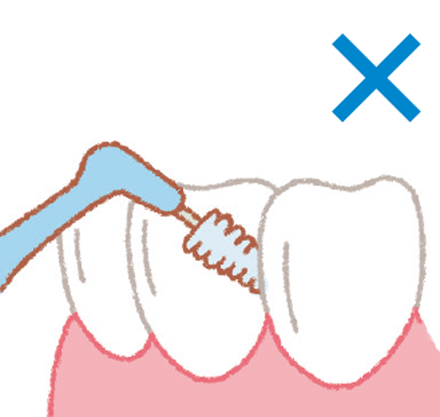 歯と歯の"スキマ"で使い分け。歯間のケアは歯間ブラシやデンタルフロスを／口と歯 1806p051_02.jpg