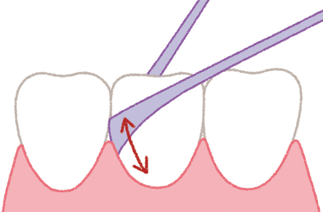 歯と歯の"スキマ"で使い分け。歯間のケアは歯間ブラシやデンタルフロスを／口と歯 1806p051_03.jpg