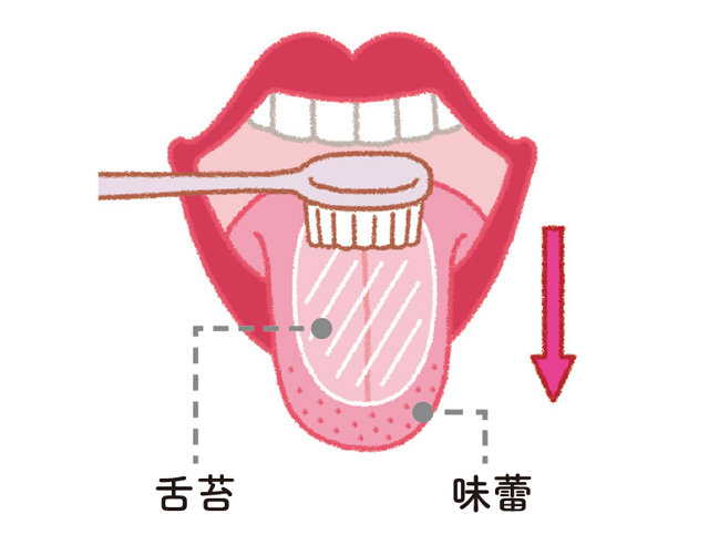 舌に苔が生える!?歯が溶ける!?　舌苔と酸蝕歯（さんしょくし）を防ぐには／口と歯 1806p055_01.jpg