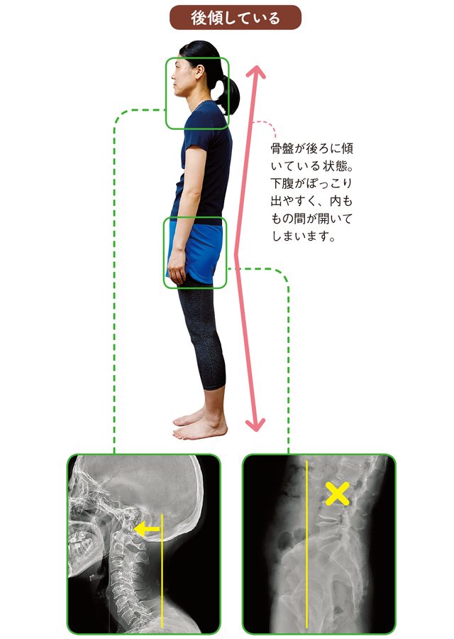 日本人女性の9割は骨盤が後倒！「体のゆがみ」基礎知識 1908p046_2.jpg