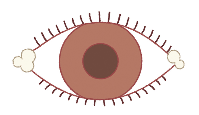 新生児の目やには典型的なものですか?