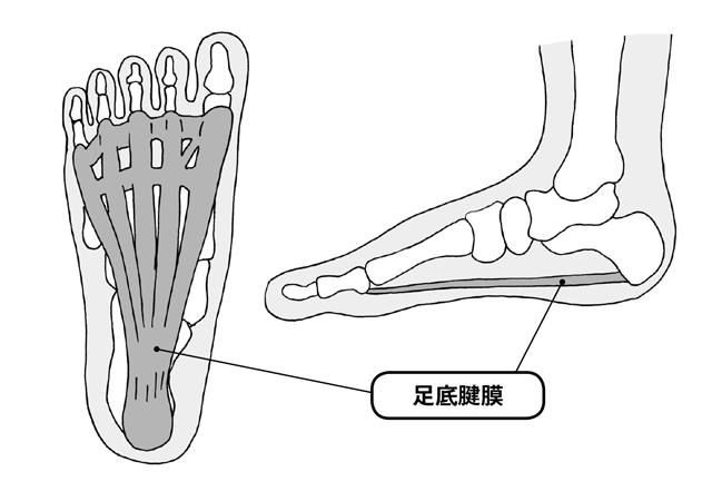 立ち仕事が多い人は注意 40歳以上がなりやすい 足底腱膜炎 の基礎知識 毎日が発見ネット