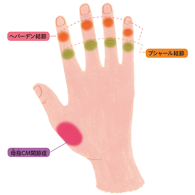 手指の痛みは病的な血管のせい？ 血流を整えて痛みを改善する「テーピング」の方法と生活習慣の見直し 2108_P041_02.jpg