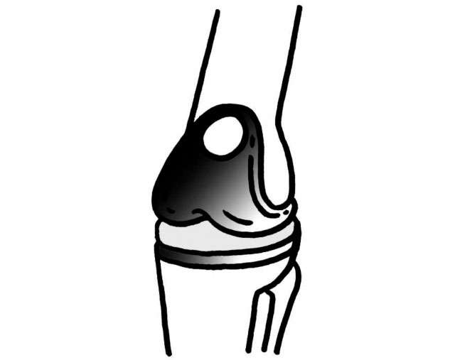 切除範囲外を削ろうとするとドリルの動きが止まるから安全！ 人工膝関節の「ロボット支援手術」 2201_P098_03.jpg