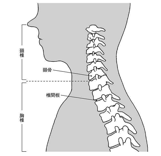 肩こりに潜む「首の痛み」は、全身の症状につながる前触れ？ 自然には治らない「首の病気」 2202_P083_01.jpg