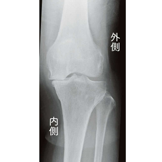「ひざの痛み」を改善！ 痛みの原因となる軟骨を再生させる「足ぶらぶら体操」 2204_P021_04.jpg