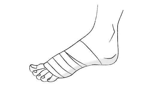靴を履かなくても痛む場合も...「外反母趾」は早期セルフケアで悪化を食い止めて 2302_P083_03_W500.jpg