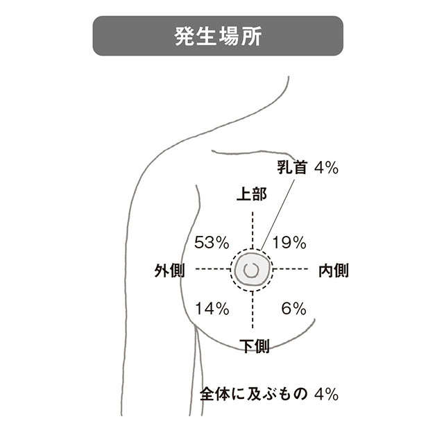 専門医の大野真司先生が警鐘「乳がんはゼロ期なら5年生存率はほぼ100％、だから乳がん検診を」 2307_P071_02.jpg