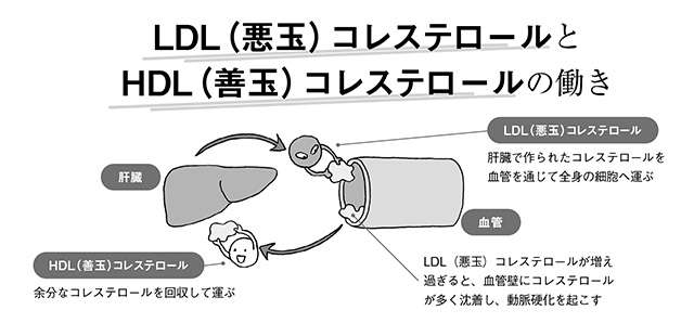 閉経後は要注意！脳梗塞などのリスクも高くなる「脂質異常症」セルフチェック【医師・栗原先生が指南】 2310_P070-071_03.jpg