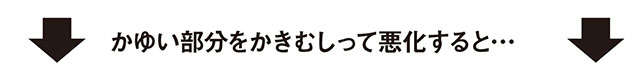 冬に気になる「肌のかゆみ」。保湿剤の効果的な使い方など、予防法や原因を皮膚科医の戸倉新樹先生が解説 2312_P075_03.jpg