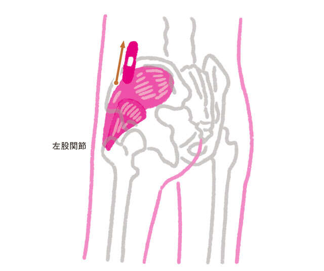 股関節の痛みにアプローチ!「絆創膏」でできる筋肉への刺激方法【理学療法士が教える】 0804.jpg
