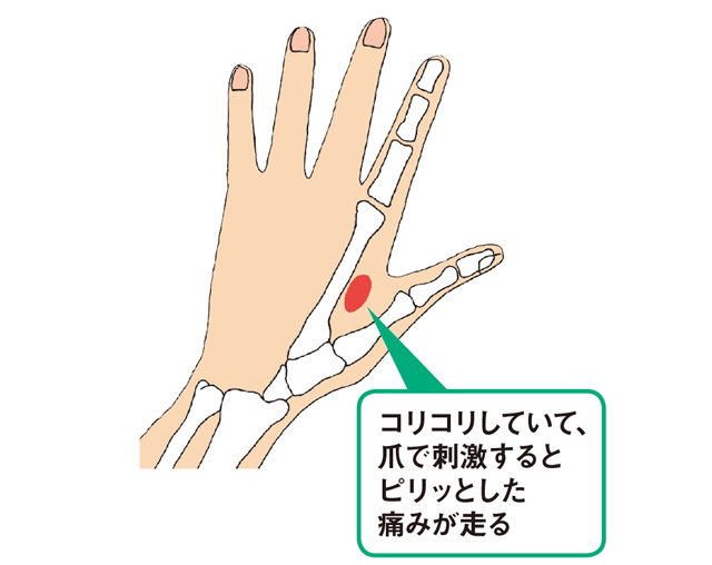 手根管症候群などに。爪を立てて刺激する「人さし指の付け根」の10秒神経マッサージ 2001p059_02.jpg