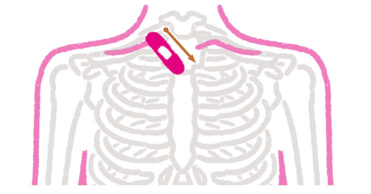 【絆創膏を貼るだけ】「五十肩」の痛みの原因にアプローチする方法 0604.jpg