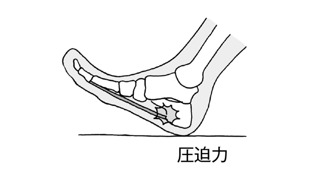 立ち仕事が多い人は注意！40歳以上がなりやすい「足底腱膜炎」の基礎知識 1910p087_03.jpg