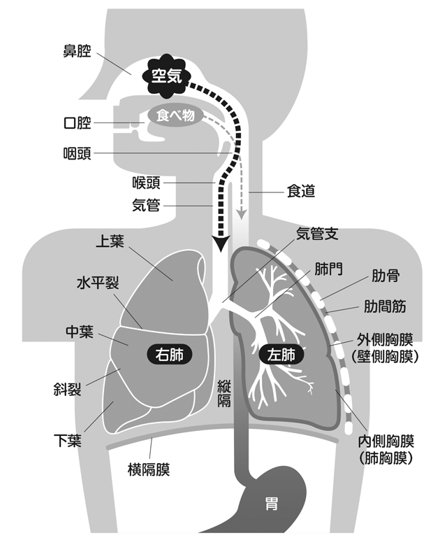 タバコさえなければ半数に減少！？ 禁煙で「肺がん」予防／やさしい家庭の医学 螳ｶ蠎ｭ縺ｮ蛹ｻ蟄ｦ_web逕ｨ蝗ｳ迚・kateiigaku_p099.jpg