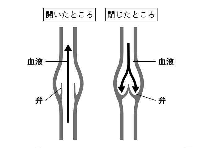 「下肢静脈瘤」はなぜ起こる？ 身体の仕組みを理解して「リスク」に備えよう 荳玖い髱呵ц逖､_逕ｻ蜒・kashi_P081_03.jpg