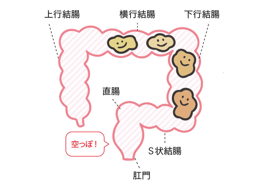 出したのにお腹が張るのは、おしりの「出口」で事件が発生!? 「出口の便秘」とは【チェックシート付】 benpi_021_01.jpg