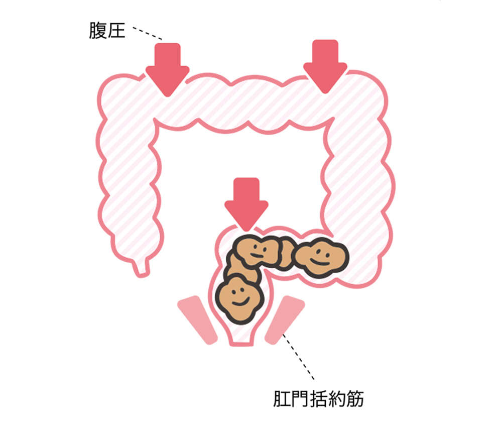 出したのにお腹が張るのは、おしりの「出口」で事件が発生!? 「出口の便秘」とは【チェックシート付】 benpi_021_03r.jpg