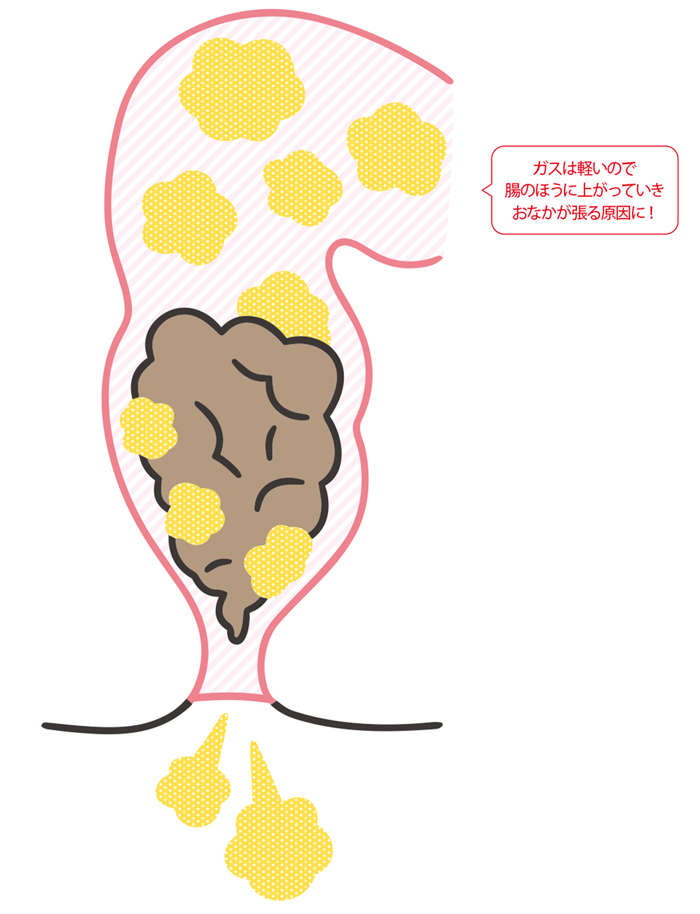 おなかがゆるい、下痢をくり返す。実はこれも「便秘」!? 汗や口のニオイにも関係する「出口の便秘」 おならがもれるのも、出残り便があるから