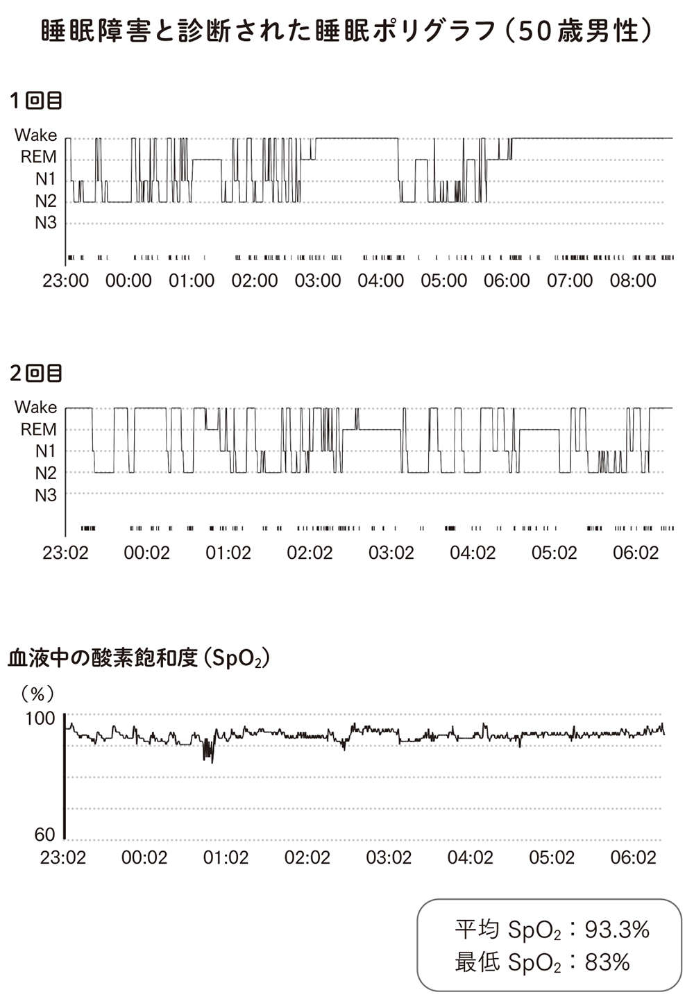 中高年になるとぐっすり眠れないのはなぜ？ 危ない睡眠と良い睡眠の違いを、脳内科医が解説 chukonensuiminzu_honbun-43.jpg