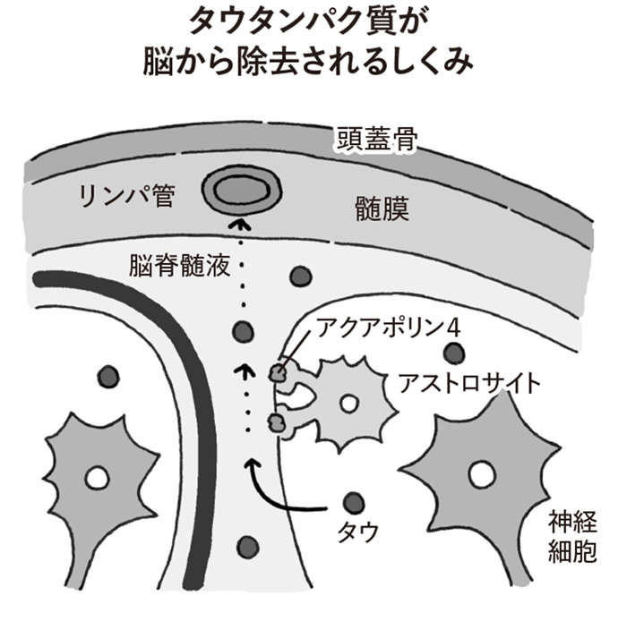 歯周病、睡眠不足、カビが、認知症を引き寄せる？ 【認知症予防の新常識】 honbun_high-117_zu.jpg