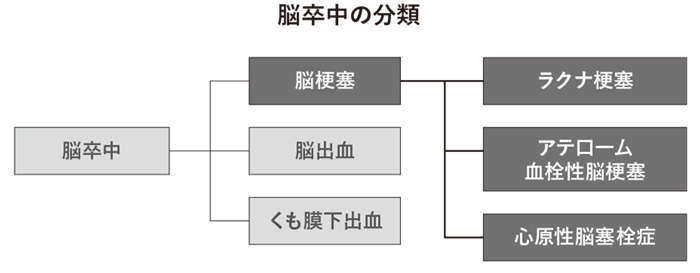 死亡率最悪の脳塞栓症、睡眠中に起こる危険な脳梗塞...3種類の「脳梗塞」に注意しよう honbun_high-37_zu.jpg